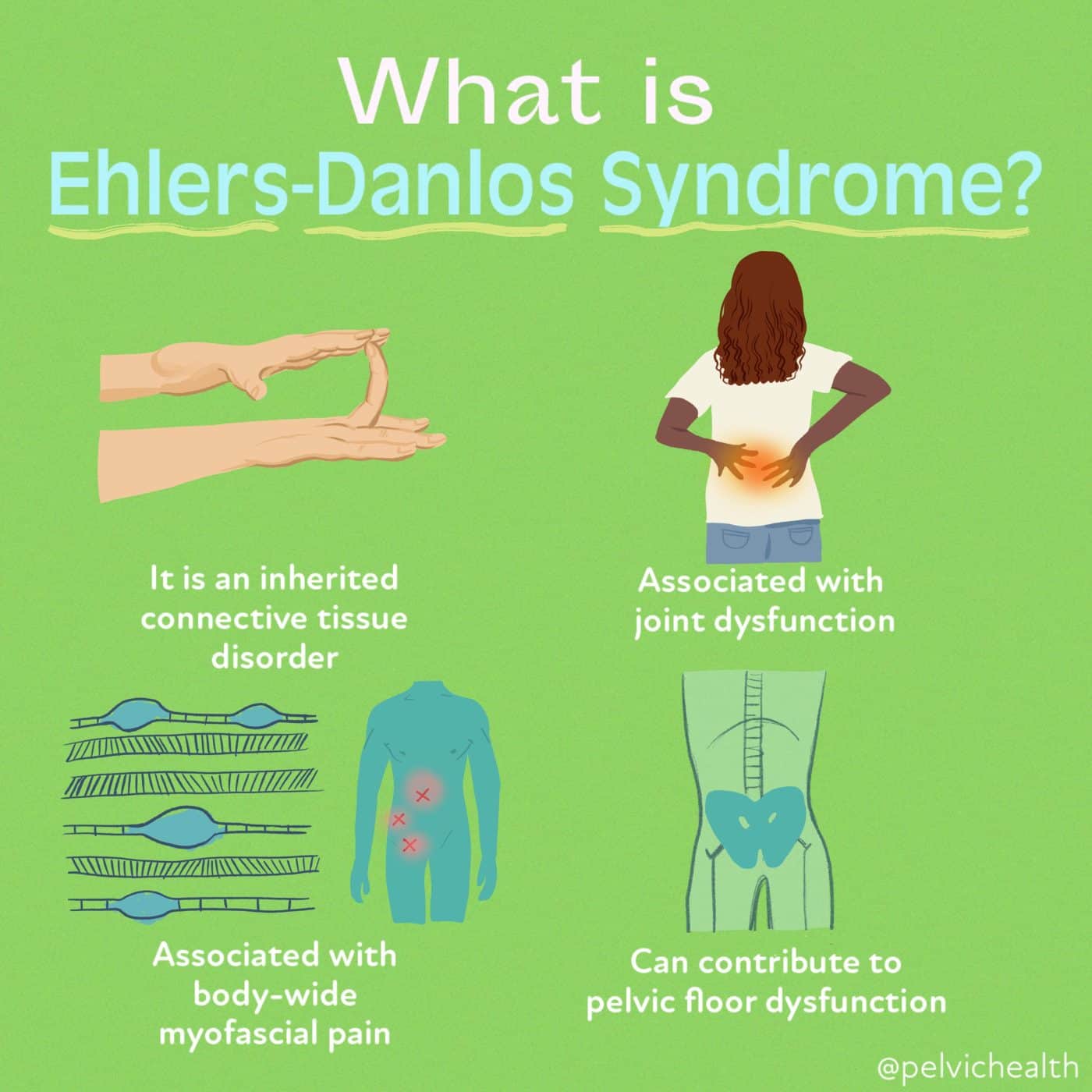 Joint hypermobility assessment for Ehlers-Danlos Syndrome diagnosis